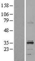NBL1-11720 - HSD11B1L Lysate